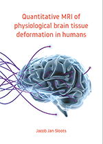 ISBN: 9789039374122 - Title: Quantitative MRI of physiological brain tissue deformation in humans
